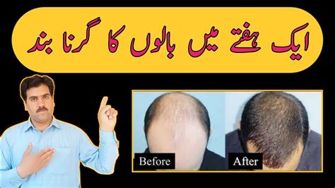 Tips For Hair Fall Baal Girne Ka Totka Health Tube YouTube