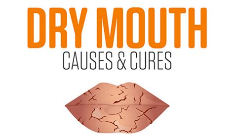 Dry Mouth Causes And Cures #Infographic - Visualistan