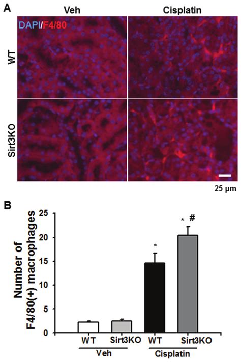 Effects Of Sirt On Cisplatin Induced Macrophage Infiltration A