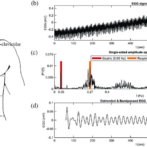 Electrogastrography Electrode Placement And Representative Data A Download Scientific