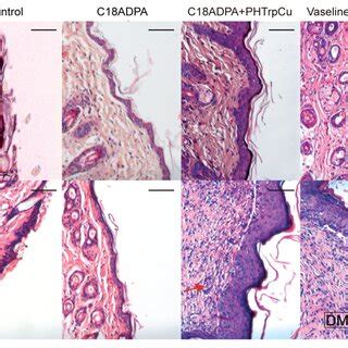 Histological Images Of Wound Healing In Mice Images Of Tissue Sections