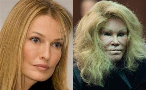 See Jocelyn Wildenstein S Shocking Plastic Surgery Transformation Right