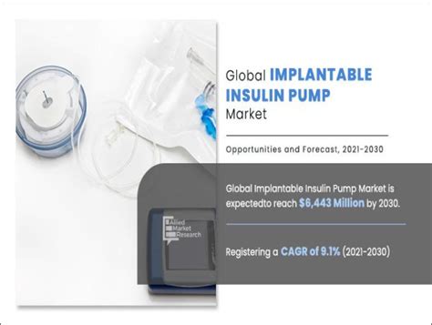 Implantable Insulin Pump Market Report Latest Trends And Future Opportunities Analysis 2024 2030