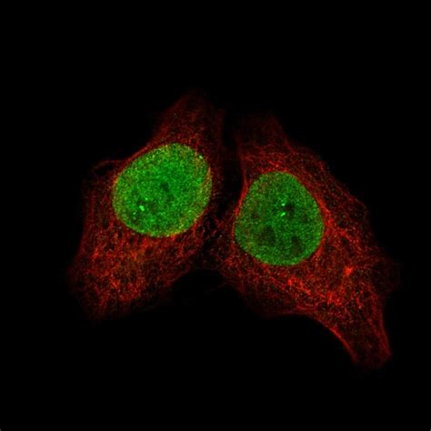 Sall4 Antibody Cl12183 Novus Biologicals 100 μg Unconjugated