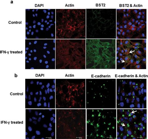 Immunofluorescent Profile Of Bst And E Cadherin In Htr Svneo Cells