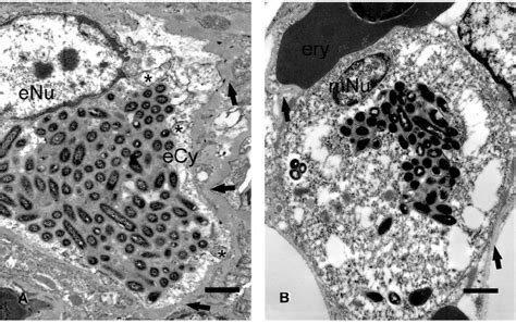 Transmission Electron Photomicrographs Showing Aggregates Of Bacteria