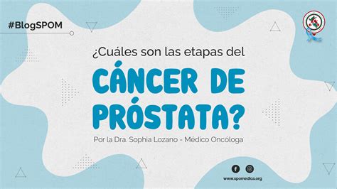 ¿cuáles Son Las Etapas Estadios Del Cáncer De Próstata Y El