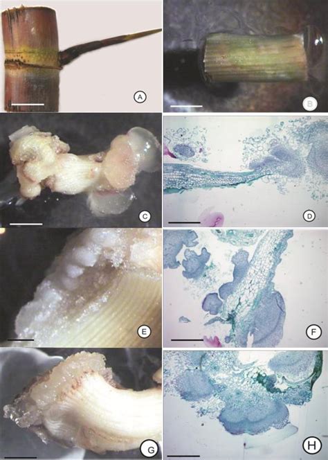 Figure From The Use Of Histological Analysis For The Detection Of