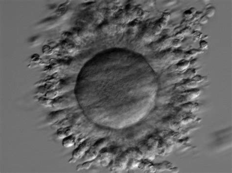 A Cumulusoocyte Complex Recovered From An Ivm Cycle The Immature