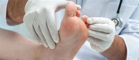 How To Recognize And Treat Fungal Infections Of The Feet