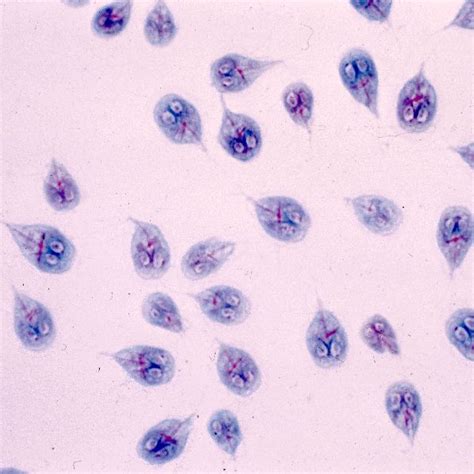 Giardia Lamblia Test Pcr Helisa Laboratorium