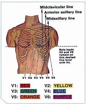 The Nursing Blog: ECG Precordial Leads placement