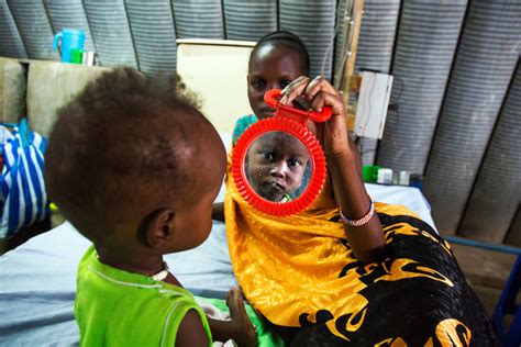 Haunting Pictures Show The Forgotten Starving Children Of South Sudan