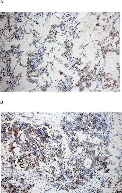 P120 Catenin A And E Cadherin B Expression In Pas Ductal Cells Download Scientific Diagram