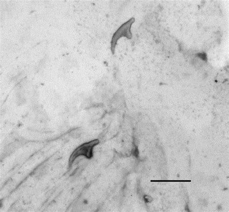 Gram Stain Of The Cyst Wall Showing Two Echinococcus Hooks Download Scientific Diagram