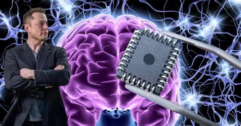 ¿cuáles Son Los ‘súper Poderes Del Primer Ser Humano Con Un Chip De Ia En Su Cerebro