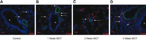 Accumulation Of Cd Positive Cells Into Ph Rat Lung Cd Cells A D