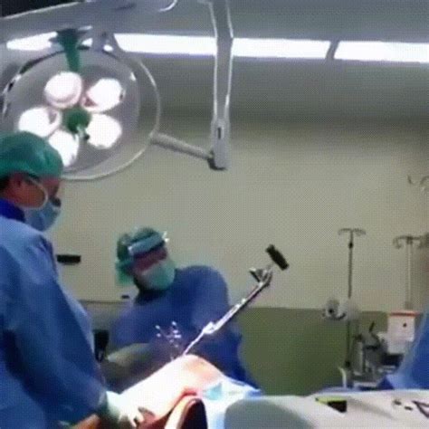 Knee Surgery Its A Delicate Operation  On Imgur Funny