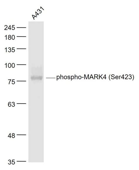 Phospho Mark Ser Rabbit Anti Human Polyclonal Bioss L