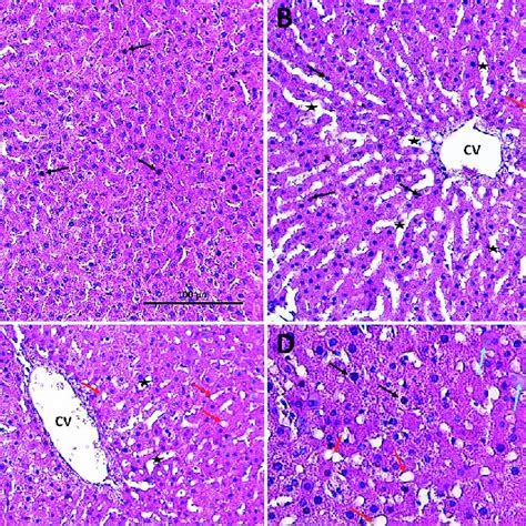 Photomicrographs Of Liver Tissue Stained With He Are Shown Figure 1a