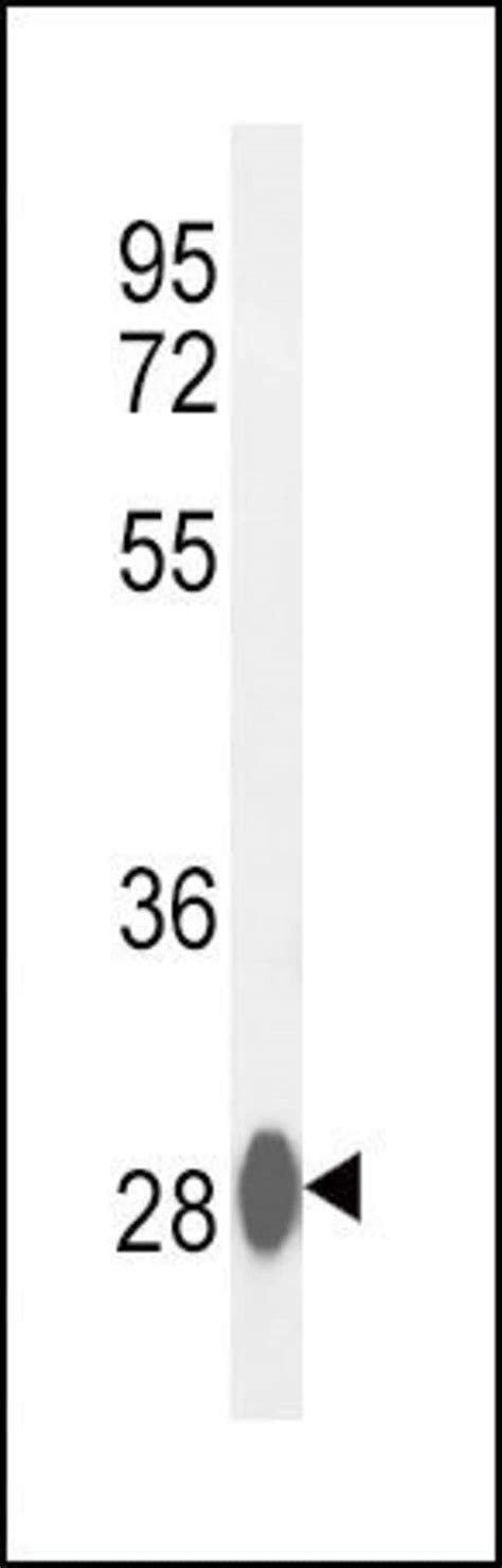 Carbonic Anhydrase III Polyclonal Antibody Invitrogen 400 μL