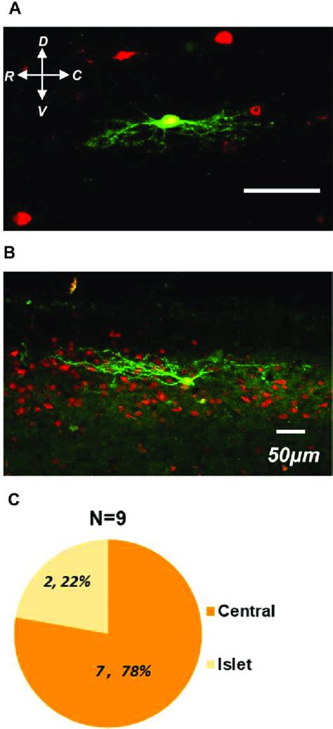 Morphologic Features Of Glyt2 Tdtomato Neurons In Parasagittal Spinal