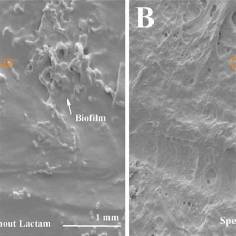 A SEM Images Of SPEEK Showing S Mutans Biofilms S M On The