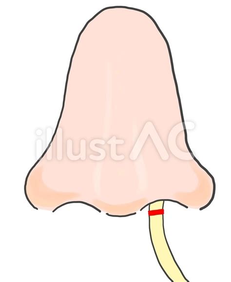 Free Vectors Nasal Tube Feeding Marking