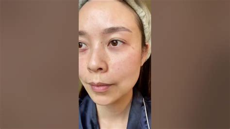 Meiyong Meyyong 1 Set 3 Creams For Melasma Freckles Spot Original From Thailandworldwide