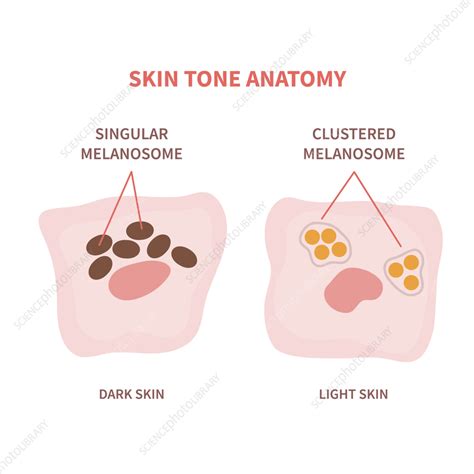 Skin tone, conceptual illustration - Stock Image - F041/3207 - Science Photo Library