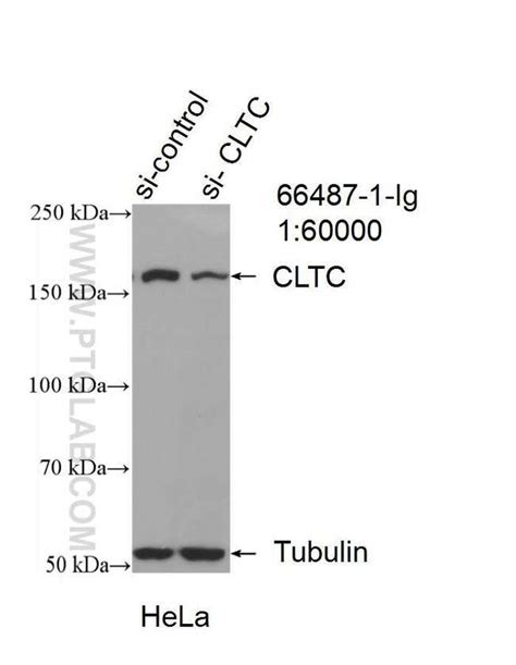 Proteintech Cltc Mouse Anti Human Mouse Porcine Rat Clone 1b3d7