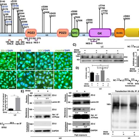 Activation of the CaSR PKCε signaling pathway reduces the cytoplasmic