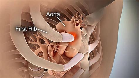 Patah Tulang Rusuk Kerangka Medis Mri Memindai Tulang Jantung Manusia