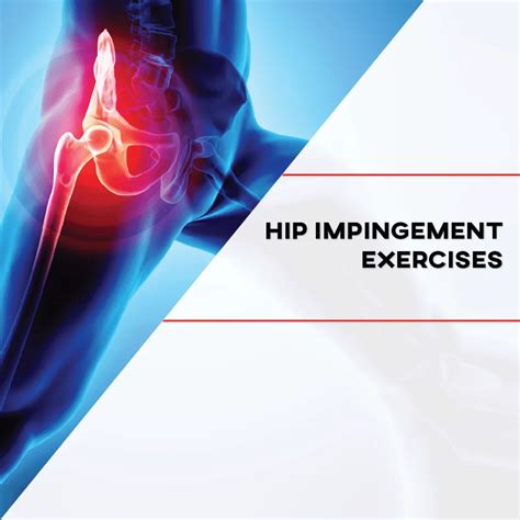 Hip impingement exercises – Artofit