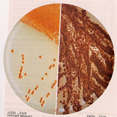 Bd Bbl Dehydrated Culture Media Biggy Agar Biggy Agar 500g