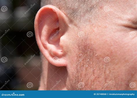 Ear Royalty Free Stock Photos - Image: 35748068