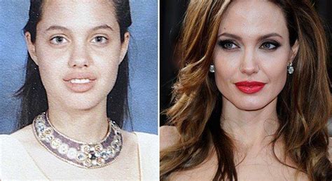 Angelina Jolie Antes E Depois - angelina-jolie-antes-depois-641x350 | Celebridades, Angelina jolie ...