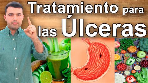 Introducir Imagen Recetas Para Ulceras Estomacales Abzlocal Mx