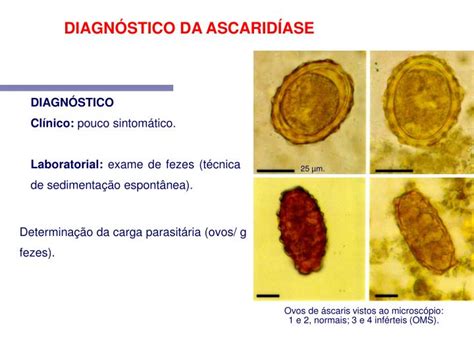 Ppt Ascaris Lumbricoides Linaeus 1758 Nomes Populares Lombriga Bicha Powerpoint