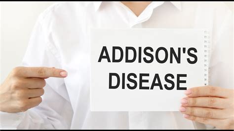 Addisons Disease Symptoms And Causes Diagnosis Treatment