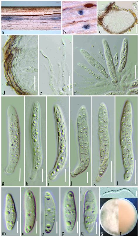 Microdochium Shilinense HKAS 123198 Holotype A B Appearance Of