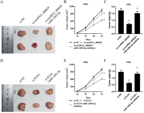 CircRNA 400029 Promotes The Aggressive Behaviors Of Cervical Cancer By