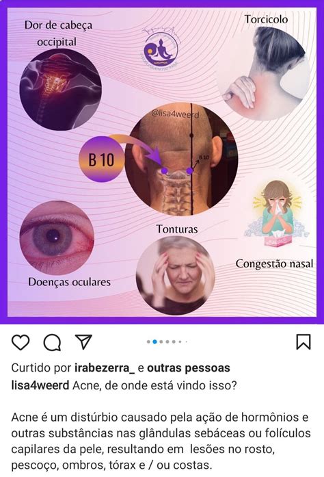 Pin De Ana Karla Em Crescimento Pessoal Acupress O Pontos De