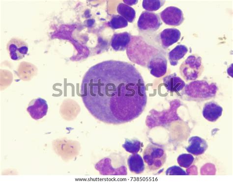 Mesothelial Cell Stock Photo (Edit Now) 738505516