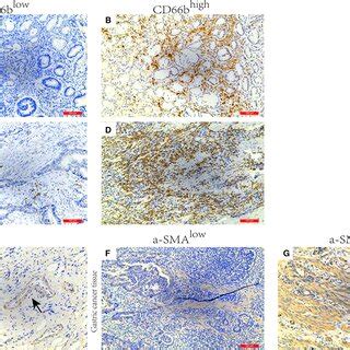 Immunohistochemical images of αSMA and CD66b expression in gastric