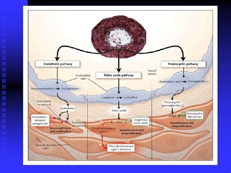 Pulmonary Hypertension Kazemi Toba M D Birjand University