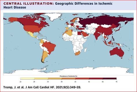 Global Differences In Burden And Treatment Of Ischemic Heart Disease In