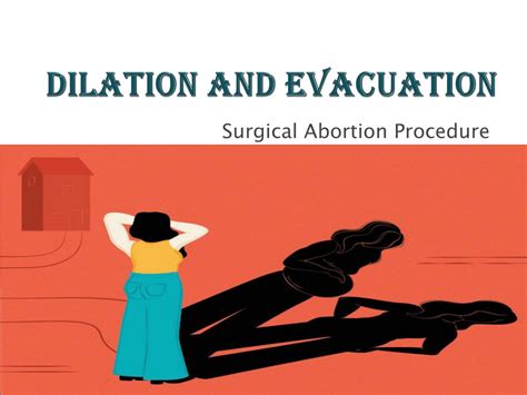 PPT - Dilation and Evacuation – Surgical Abortion Procedure PowerPoint Presentation - ID:10807852