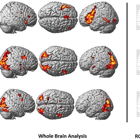 Left Whole Brain Activation Pattern As Assessed By A Mixed Effects