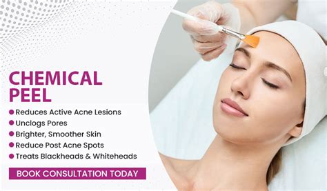 Chemical Peels Skin4uclinics